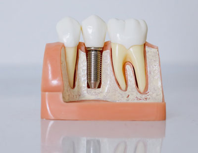 dental care image Dentist