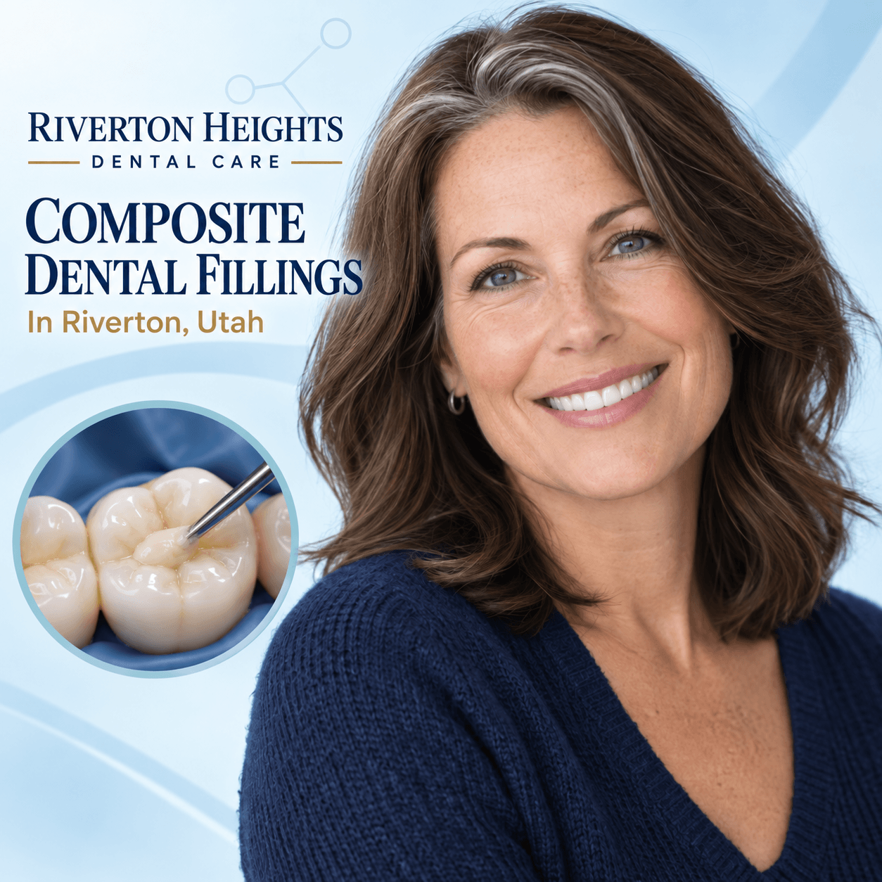 Best Composite Dental Fillings In Riverton, Utah