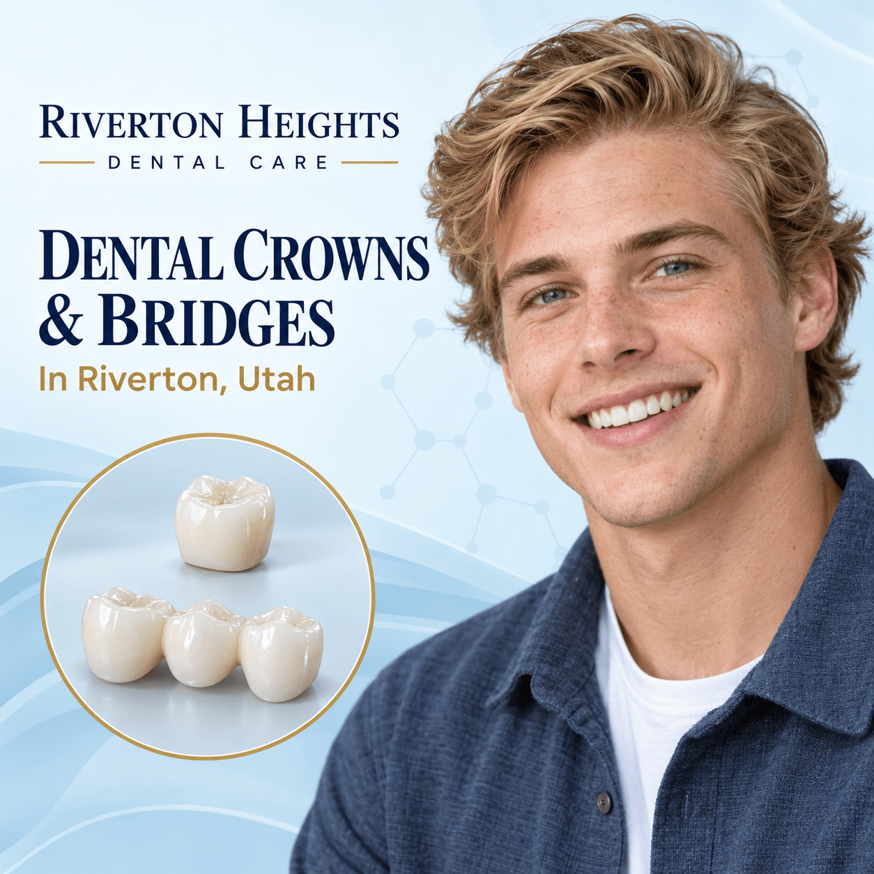 Best Dental Crowns and Bridges In Riverton, Utah