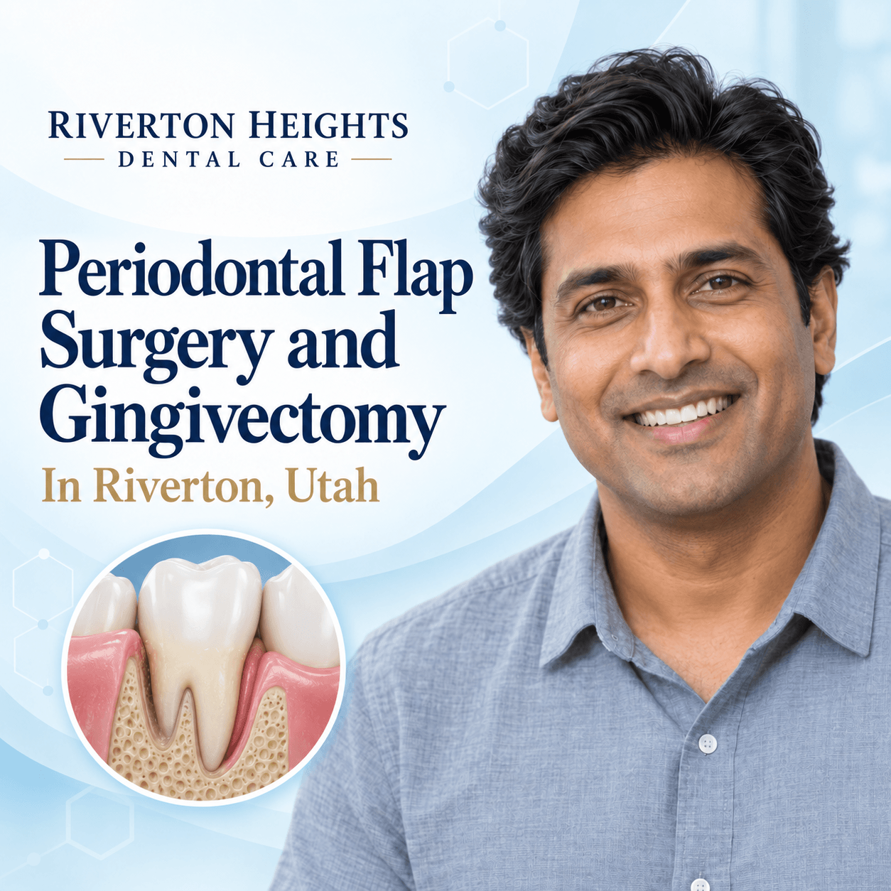 Best Periodontal Flap Surgery In Riverton, Utah