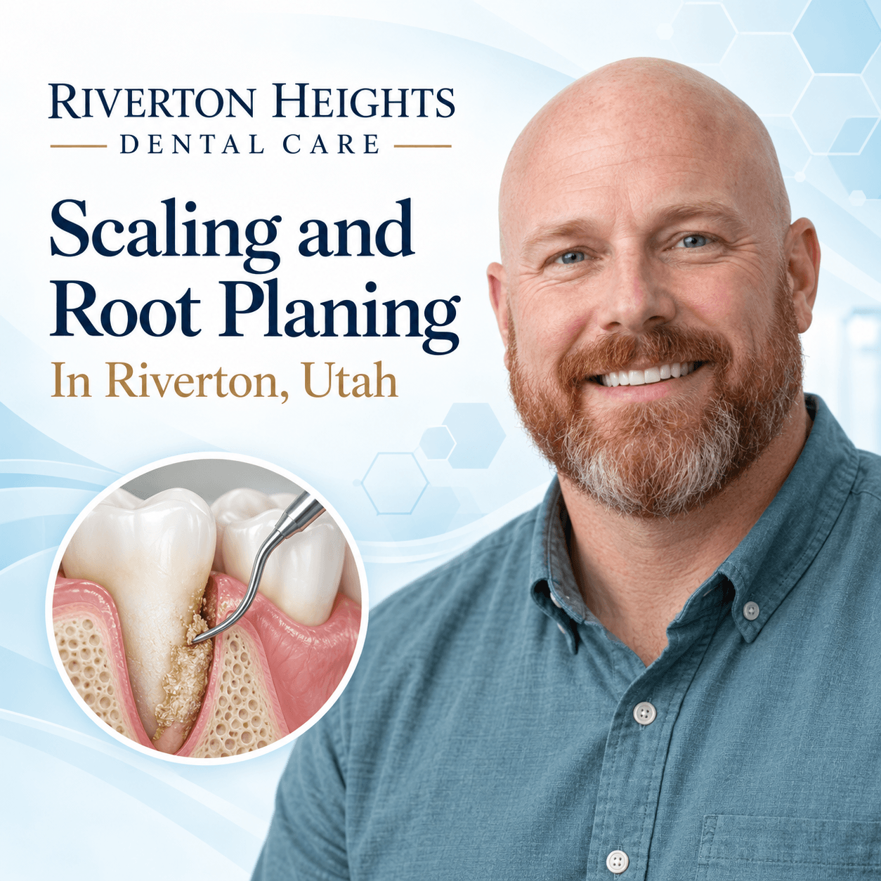 Best Scaling and Root Planing In Riverton, Utah