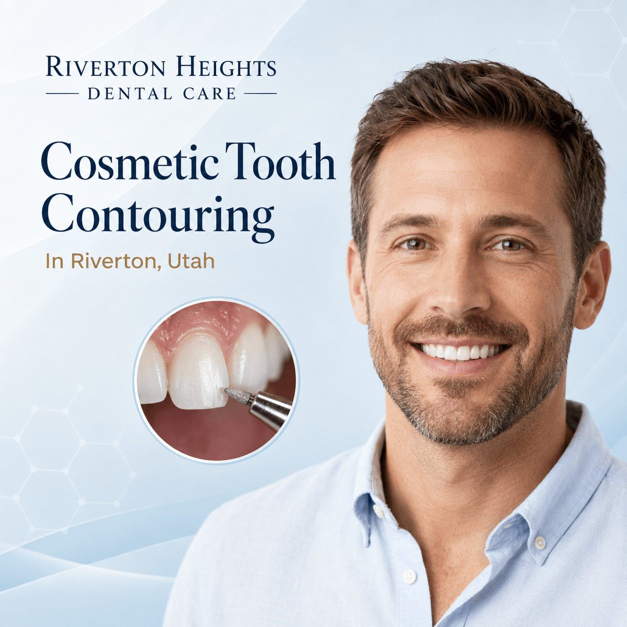 Expert Cosmetic Tooth Contouring In Riverton, Utah