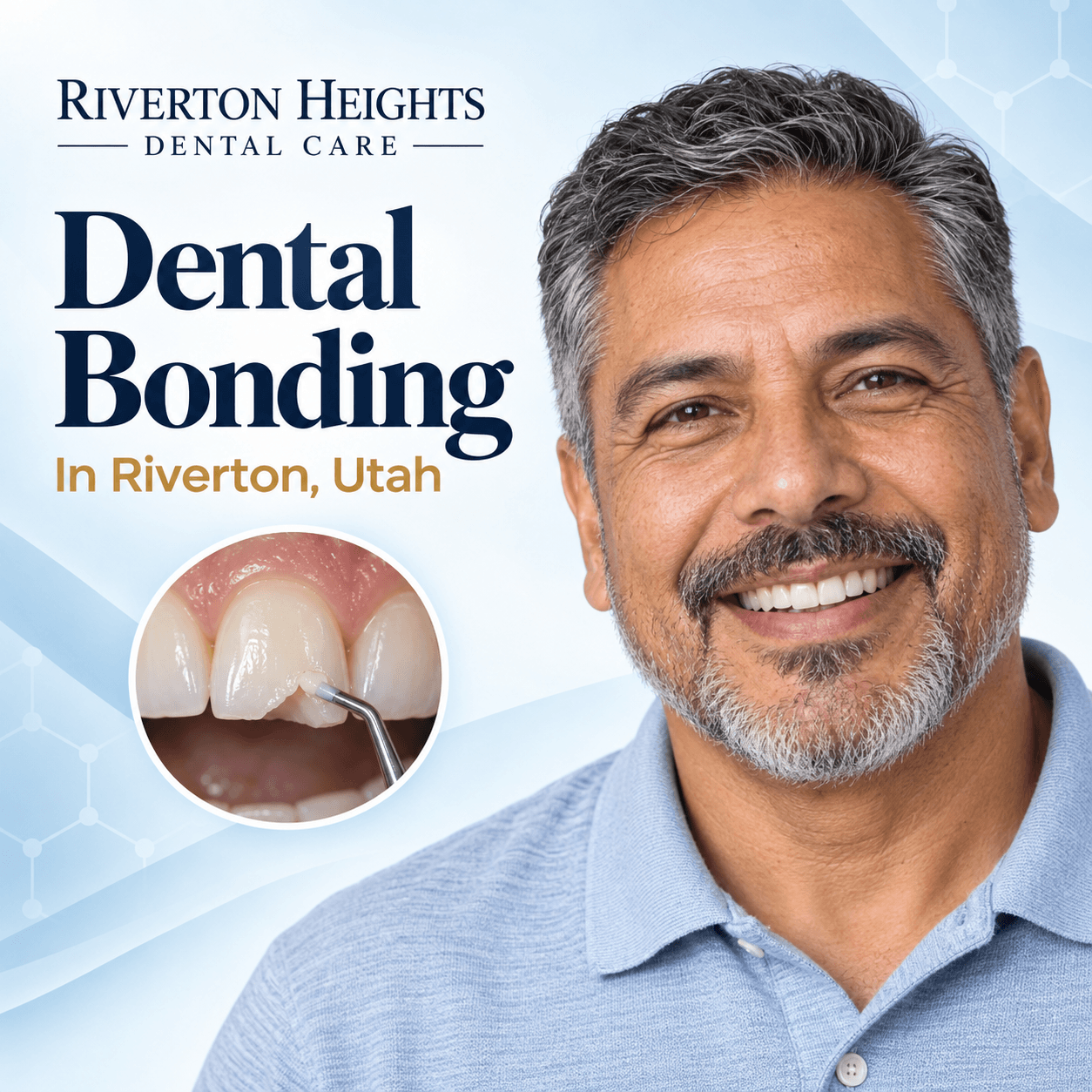 Quality Dental Bonding In Riverton, Utah