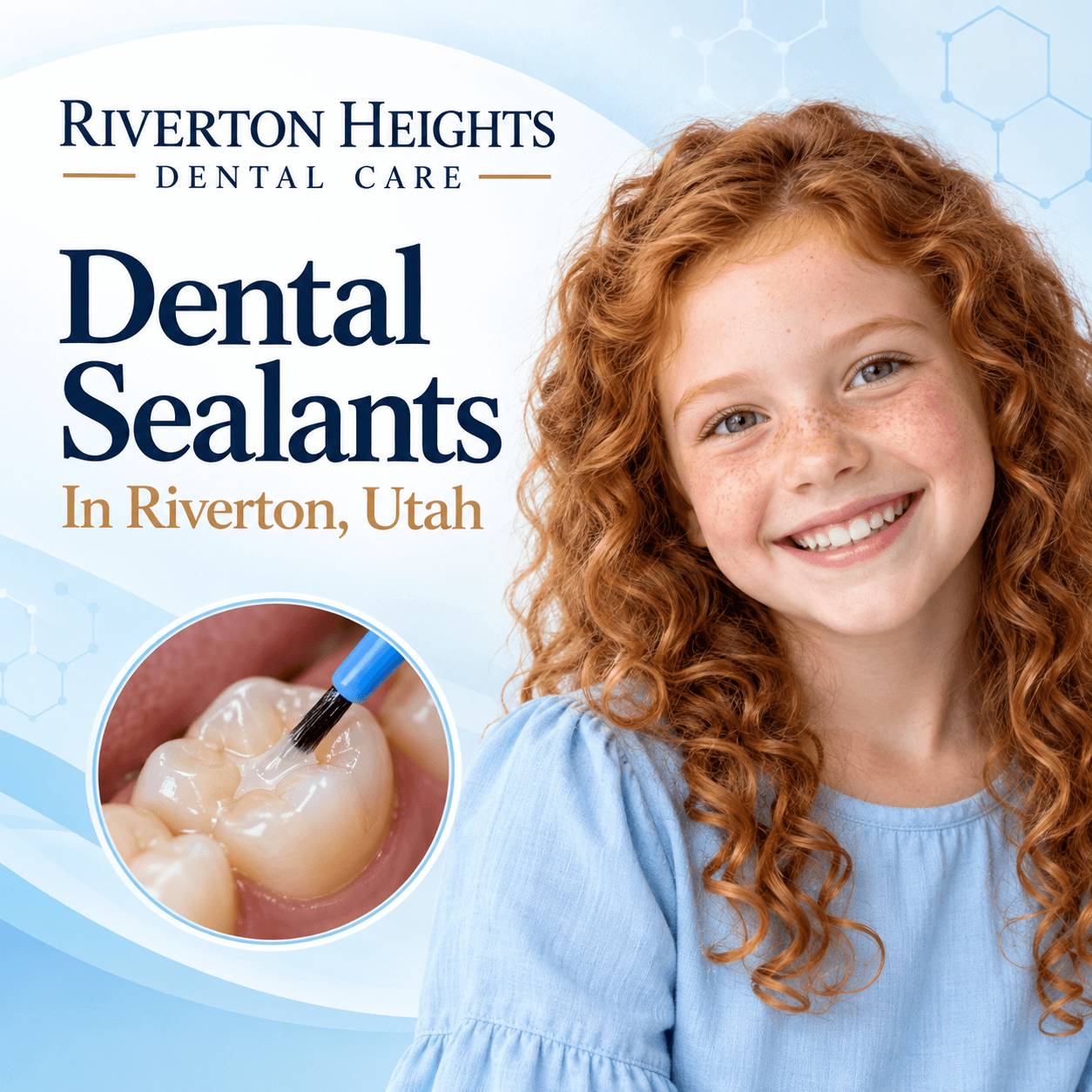Quality Dental Sealants In Riverton, Utah