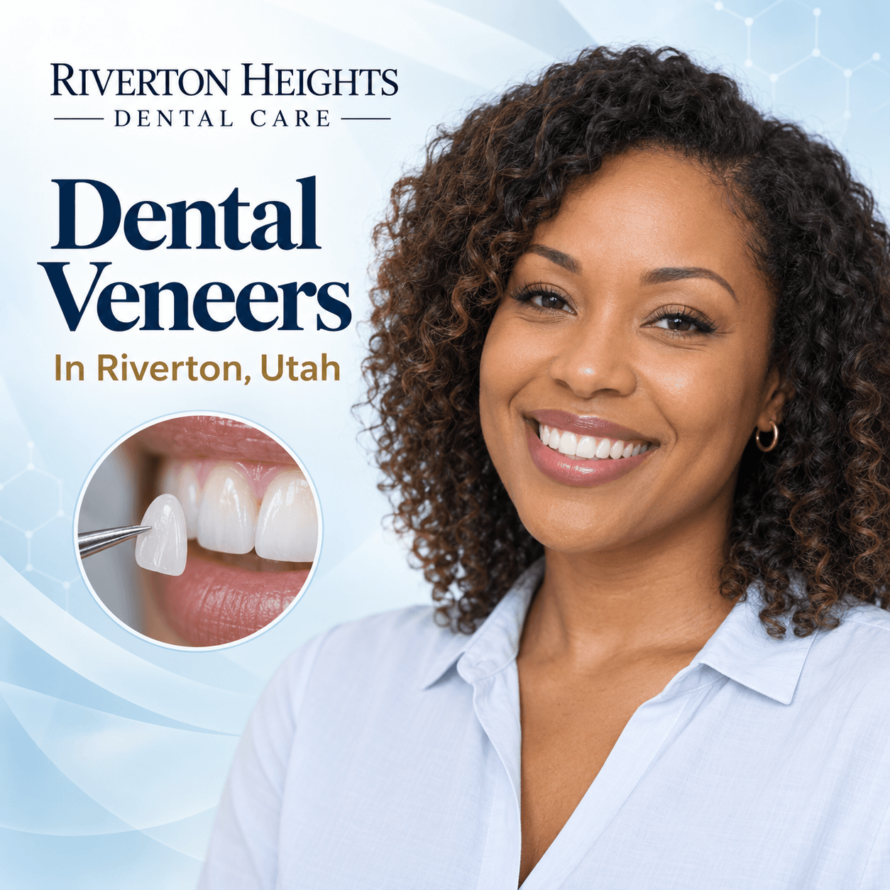 Quality Dental Veneers In Riverton, Utah